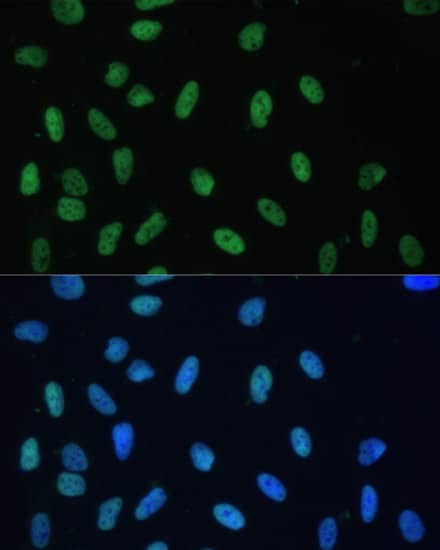 Immunocytochemistry/ Immunofluorescence: AUF1 Antibody [NBP3-35586] - Immunofluorescence analysis of U-2 OS cells using AUF1 Rabbit pAb at dilution of 1:100. Secondary antibody: Cy3-conjugated Goat anti-Rabbit IgG (H+L) at 1:500 dilution. Blue: DAPI for nuclear staining.