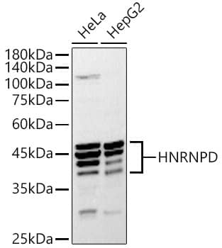 Western Blot: AUF1 Antibody [NBP3-35586] - Western blot analysis of various lysates using AUF1 Rabbit pAb at 1:1000 dilution.Secondary antibody: HRP-conjugated Goat anti-Rabbit IgG (H+L) at 1:10000 dilution.Lysates/proteins: 25ug per lane.Blocking buffer: 3% nonfat dry milk in TBST.Detection: ECL Basic Kit.Exposure time: 30s.