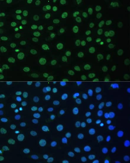 Immunocytochemistry/ Immunofluorescence: AUF1 Antibody [NBP3-35586] - Immunofluorescence analysis of C6 cells using AUF1 Rabbit pAb at dilution of 1:100. Secondary antibody: Cy3-conjugated Goat anti-Rabbit IgG (H+L) at 1:500 dilution. Blue: DAPI for nuclear staining.