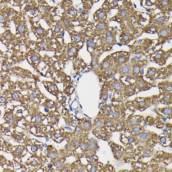 Immunohistochemistry: Monoamine Oxidase B Antibody [NBP3-35587] - Immunohistochemistry analysis of paraffin-embedded Rat liver using Monoamine Oxidase B(MAOB) Rabbit pAb at dilution of 1:100 (40x lens). High pressure antigen retrieval performed with 0.01M Citrate Bufferr (pH 6.0) prior to IHC staining.