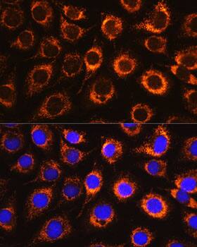 Immunocytochemistry/ Immunofluorescence: Monoamine Oxidase B Antibody [NBP3-35587] - Immunofluorescence analysis of L929 cells using Monoamine Oxidase B(Monoamine Oxidase B(MAOB)) Rabbit pAb at dilution of 1:100. Secondary antibody: Cy3-conjugated Goat anti-Rabbit IgG (H+L) at 1:500 dilution. Blue: DAPI for nuclear staining.