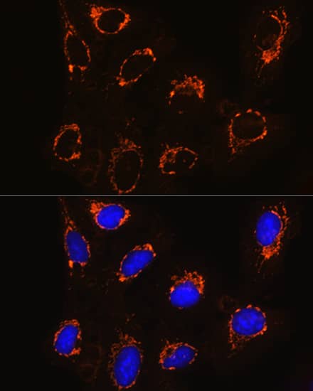 Immunocytochemistry/ Immunofluorescence: Monoamine Oxidase B Antibody [NBP3-35587] - Immunofluorescence analysis of U2OS cells using Monoamine Oxidase B(Monoamine Oxidase B(MAOB)) Rabbit pAb at dilution of 1:100. Secondary antibody: Cy3-conjugated Goat anti-Rabbit IgG (H+L) at 1:500 dilution. Blue: DAPI for nuclear staining.