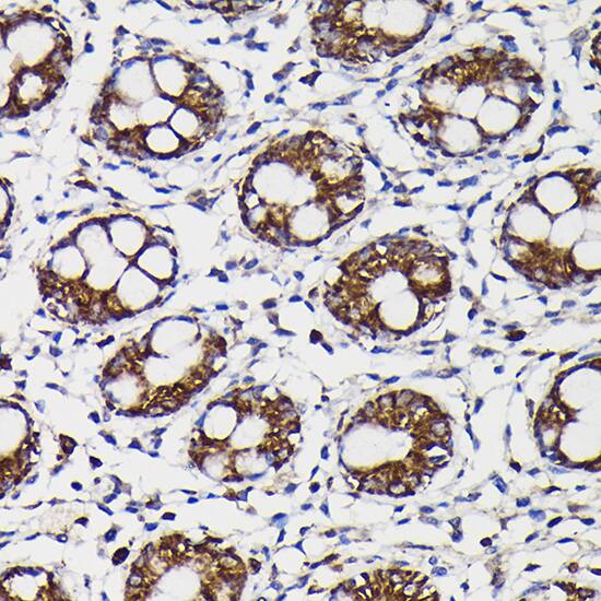 Immunohistochemistry: Monoamine Oxidase B Antibody [NBP3-35587] - Immunohistochemistry analysis of paraffin-embedded Human colon using Monoamine Oxidase B(MAOB) Rabbit pAb at dilution of 1:100 (40x lens). High pressure antigen retrieval performed with 0.01M Citrate Bufferr (pH 6.0) prior to IHC staining.