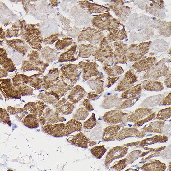 Immunohistochemistry: Monoamine Oxidase B Antibody [NBP3-35587] - Immunohistochemistry analysis of paraffin-embedded Rat heart using Monoamine Oxidase B(MAOB) Rabbit pAb at dilution of 1:100 (40x lens). High pressure antigen retrieval performed with 0.01M Citrate Bufferr (pH 6.0) prior to IHC staining.