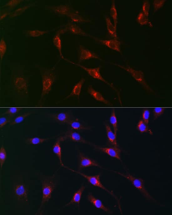 Immunocytochemistry/ Immunofluorescence: Monoamine Oxidase B Antibody [NBP3-35587] - Immunofluorescence analysis of NIH/3T3 cells using Monoamine Oxidase B(MAOB) Rabbit pAb at dilution of 1:100 (40x lens). Secondary antibody: Cy3-conjugated Goat anti-Rabbit IgG (H+L) at 1:500 dilution. Blue: DAPI for nuclear staining.