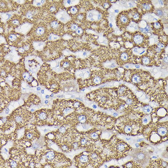 Immunohistochemistry: Monoamine Oxidase B Antibody [NBP3-35587] - Immunohistochemistry analysis of paraffin-embedded Human liver using Monoamine Oxidase B(MAOB) Rabbit pAb at dilution of 1:100 (40x lens). High pressure antigen retrieval performed with 0.01M Citrate Bufferr (pH 6.0) prior to IHC staining.