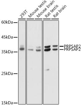 Western Blot: PRPSAP2 Antibody [NBP3-35590] - Western blot analysis of various lysates using PRPSAP2 Rabbit pAb at 1:1000 dilution.Secondary antibody: HRP-conjugated Goat anti-Rabbit IgG (H+L) at 1:10000 dilution.Lysates/proteins: 25ug per lane.Blocking buffer: 3% nonfat dry milk in TBST.Detection: ECL Basic Kit.Exposure time: 10s.