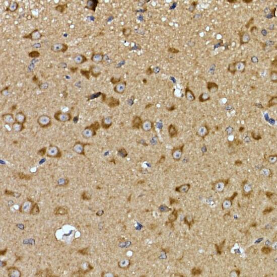 Immunohistochemistry: PRPSAP2 Antibody [NBP3-35590] - Immunohistochemistry analysis of paraffin-embedded Mouse brain using PRPSAP2 Rabbit pAb at dilution of 1:100 (40x lens). High pressure antigen retrieval performed with 0.01M Citrate Bufferr (pH 6.0) prior to IHC staining.