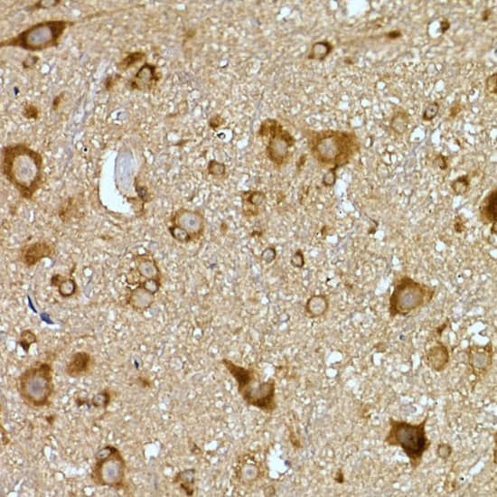 Immunohistochemistry: PRPSAP2 Antibody [NBP3-35590] - Immunohistochemistry analysis of paraffin-embedded Mouse spinal cord using PRPSAP2 Rabbit pAb at dilution of 1:100 (40x lens). High pressure antigen retrieval performed with 0.01M Citrate Bufferr (pH 6.0) prior to IHC staining.