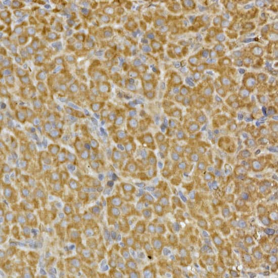 Immunohistochemistry: PRPSAP2 Antibody [NBP3-35590] - Immunohistochemistry analysis of paraffin-embedded Rat ovary using PRPSAP2 Rabbit pAb at dilution of 1:100 (40x lens). High pressure antigen retrieval performed with 0.01M Citrate Bufferr (pH 6.0) prior to IHC staining.