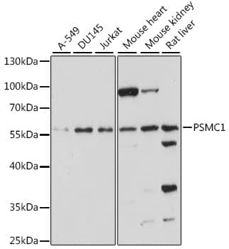 Western Blot: PSMC1 Antibody [NBP3-35591] - Western blot analysis of various lysates using PSMC1 Rabbit pAb at 1:1000 dilution.Secondary antibody: HRP-conjugated Goat anti-Rabbit IgG (H+L) at 1:10000 dilution.Lysates/proteins: 25ug per lane.Blocking buffer: 3% nonfat dry milk in TBST.Detection: ECL Basic Kit.Exposure time: 90s.