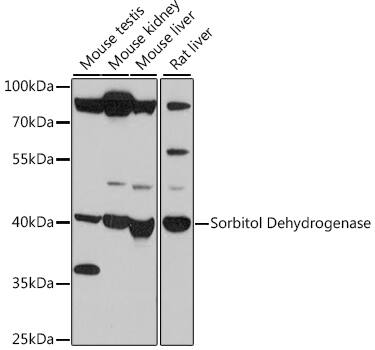 Western Blot: Sorbitol Dehydrogenase Antibody [NBP3-35592] - Western blot analysis of various lysates using Sorbitol Dehydrogenase Rabbit pAb at 1:500 dilution.Secondary antibody: HRP-conjugated Goat anti-Rabbit IgG (H+L) at 1:10000 dilution.Lysates/proteins: 25ug per lane.Blocking buffer: 3% nonfat dry milk in TBST.Detection: ECL Basic Kit.Exposure time: 90s.