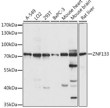 Western Blot: ZNF133 Antibody [NBP3-35593] - Western blot analysis of various lysates using ZNF133 Rabbit pAb at 1:1000 dilution.Secondary antibody: HRP-conjugated Goat anti-Rabbit IgG (H+L) at 1:10000 dilution.Lysates/proteins: 25ug per lane.Blocking buffer: 3% nonfat dry milk in TBST.Detection: ECL Basic Kit.Exposure time: 10s.