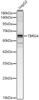 Western Blot: TBRG4 Antibody [NBP3-35595] - Western blot analysis of lysates from HepG2 cells, using TBRG4 Rabbit pAb at 1:2000 dilution.Secondary antibody: HRP-conjugated Goat anti-Rabbit IgG (H+L) at 1:10000 dilution.Lysates/proteins: 25ug per lane.Blocking buffer: 3% nonfat dry milk in TBST.Detection: ECL Basic Kit.Exposure time: 30s.