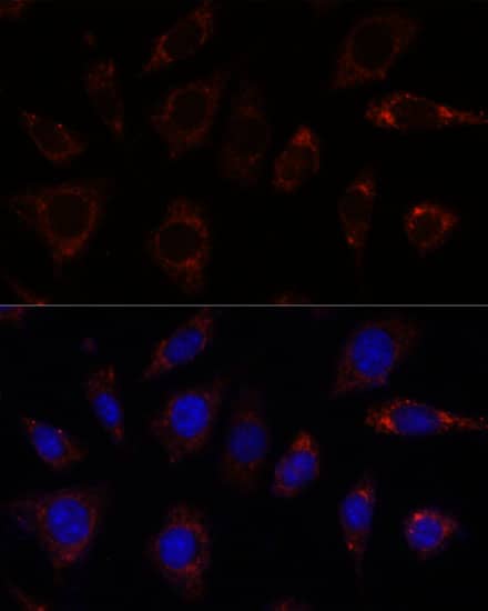 Immunocytochemistry/ Immunofluorescence: TBRG4 Antibody [NBP3-35595] - Immunofluorescence analysis of L929 cells using TBRG4 Rabbit pAb at dilution of 1:100. Secondary antibody: Cy3-conjugated Goat anti-Rabbit IgG (H+L) at 1:500 dilution. Blue: DAPI for nuclear staining.