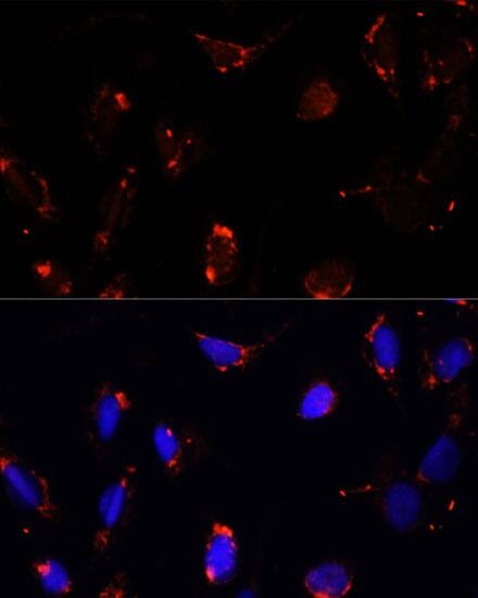 Immunocytochemistry/ Immunofluorescence: TBRG4 Antibody [NBP3-35595] - Immunofluorescence analysis of U-2 OS cells using TBRG4 Rabbit pAb at dilution of 1:100. Secondary antibody: Cy3-conjugated Goat anti-Rabbit IgG (H+L) at 1:500 dilution. Blue: DAPI for nuclear staining.