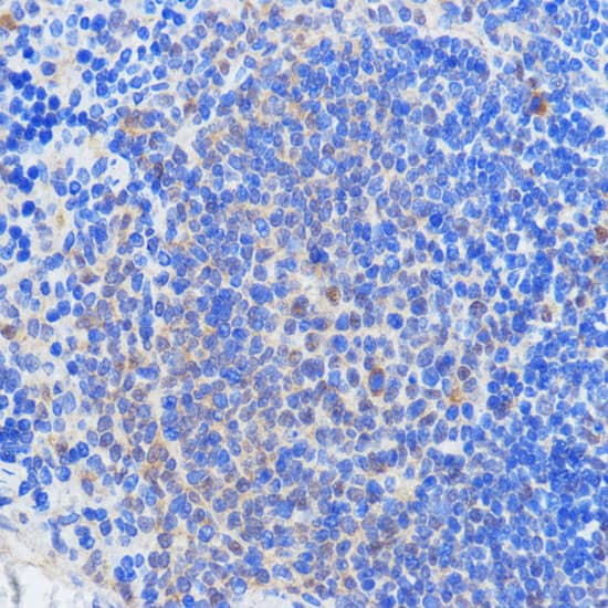 Immunohistochemistry: HCC1 Antibody [NBP3-35596] - Immunohistochemistry analysis of paraffin-embedded Mouse spleen using HCC1 Rabbit pAb at dilution of 1:100 (40x lens). Microwave antigen retrieval performed with 0.01M PBS Buffer (pH 7.2) prior to IHC staining.