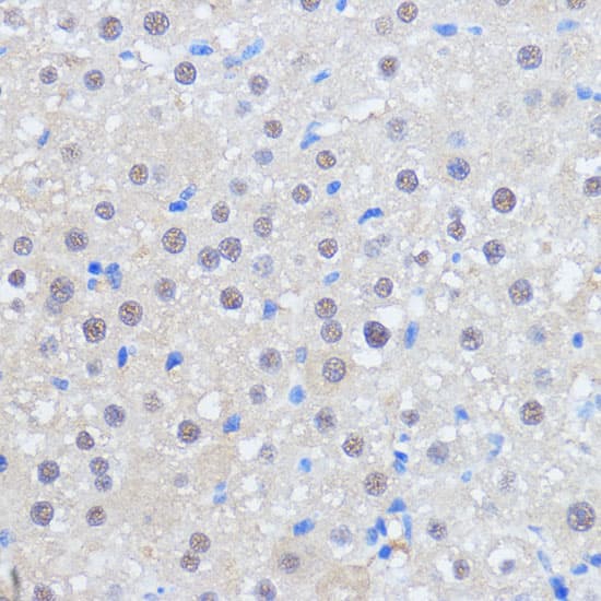 Immunohistochemistry: HCC1 Antibody [NBP3-35596] - Immunohistochemistry analysis of paraffin-embedded Rat liver using HCC1 Rabbit pAb at dilution of 1:100 (40x lens). Microwave antigen retrieval performed with 0.01M PBS Buffer (pH 7.2) prior to IHC staining.