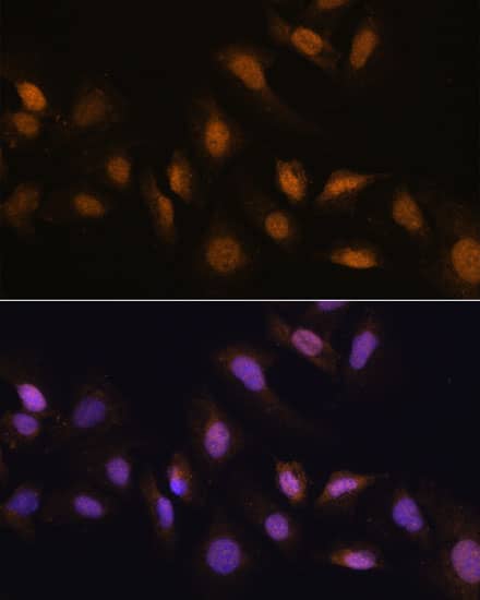 Immunocytochemistry/ Immunofluorescence: HCC1 Antibody [NBP3-35596] - Immunofluorescence analysis of U-2 OS cells using HCC1 Rabbit pAb at dilution of 1:100. Secondary antibody: Cy3-conjugated Goat anti-Rabbit IgG (H+L) at 1:500 dilution. Blue: DAPI for nuclear staining.