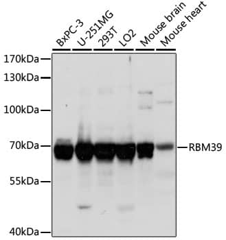 Western Blot: HCC1 Antibody [NBP3-35596] - Western blot analysis of various lysates using HCC1 Rabbit pAb at 1:1000 dilution.Secondary antibody: HRP-conjugated Goat anti-Rabbit IgG (H+L) at 1:10000 dilution.Lysates/proteins: 25ug per lane.Blocking buffer: 3% nonfat dry milk in TBST.Detection: ECL Basic Kit.Exposure time: 1s.