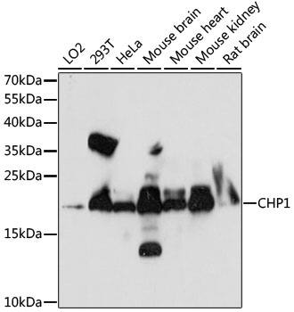 Western Blot: Calcium-binding-protein-P22 Antibody [NBP3-35602] - Western blot analysis of various lysates using Calcium-binding-protein-P22 Rabbit pAb at 1:1000 dilution.Secondary antibody: HRP-conjugated Goat anti-Rabbit IgG (H+L) at 1:10000 dilution.Lysates/proteins: 25ug per lane.Blocking buffer: 3% nonfat dry milk in TBST.Detection: ECL Enhanced Kit.Exposure time: 90s.