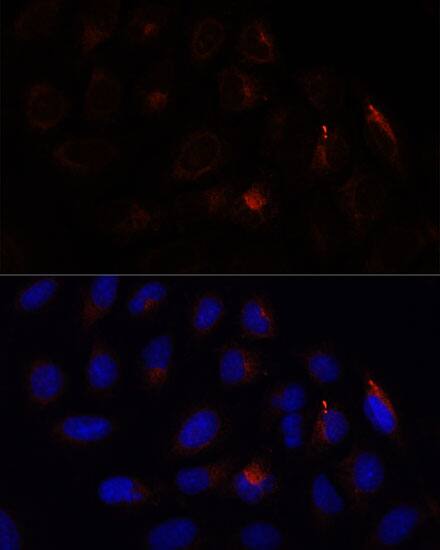 Immunocytochemistry/ Immunofluorescence: Calcium-binding-protein-P22 Antibody [NBP3-35602] - Immunofluorescence analysis of U-2 OS cells using Calcium-binding-protein-P22 Rabbit pAb at dilution of 1:100. Secondary antibody: Cy3-conjugated Goat anti-Rabbit IgG (H+L) at 1:500 dilution. Blue: DAPI for nuclear staining.