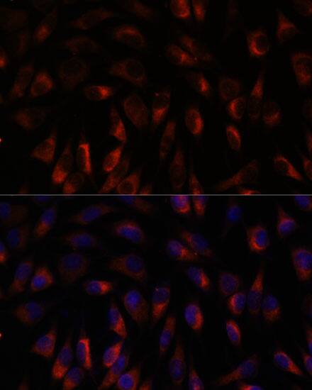 Immunocytochemistry/ Immunofluorescence: Calcium-binding-protein-P22 Antibody [NBP3-35602] - Immunofluorescence analysis of L929 cells using Calcium-binding-protein-P22 Rabbit pAb at dilution of 1:100. Secondary antibody: Cy3-conjugated Goat anti-Rabbit IgG (H+L) at 1:500 dilution. Blue: DAPI for nuclear staining.