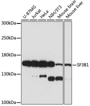 Western Blot: SAP155 Antibody [NBP3-35603] - Western blot analysis of various lysates using SAP155 Rabbit pAb at 1:1000 dilution incubated overnight at 4C.Secondary antibody: HRP-conjugated Goat anti-Rabbit IgG (H+L) at 1:10000 dilution.Lysates/proteins: 25 ug per lane.Blocking buffer: 3% nonfat dry milk in TBST.Detection: ECL Basic Kit.Exposure time: 30s.