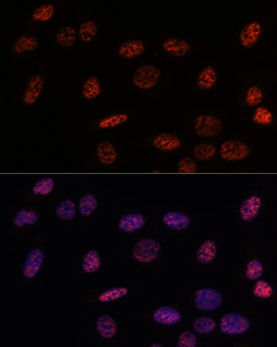 Immunocytochemistry/ Immunofluorescence: SAP155 Antibody [NBP3-35603] - Immunofluorescence analysis of U-2OS using SAP155 Rabbit pAb at dilution of d100 (40x lens). Blue: DAPI for nuclear staining.