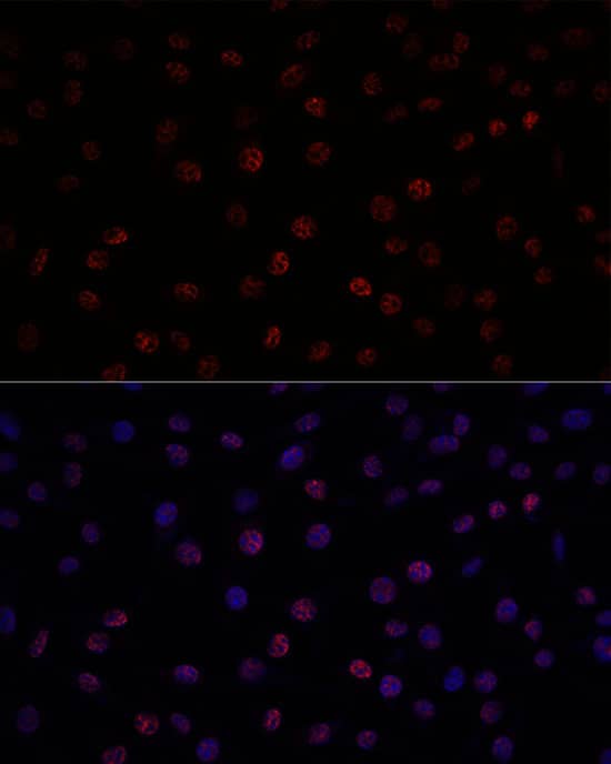 Immunocytochemistry/ Immunofluorescence: SAP155 Antibody [NBP3-35603] - Immunofluorescence analysis of L929 using SAP155 Rabbit pAb at dilution of d100 (40x lens). Blue: DAPI for nuclear staining.