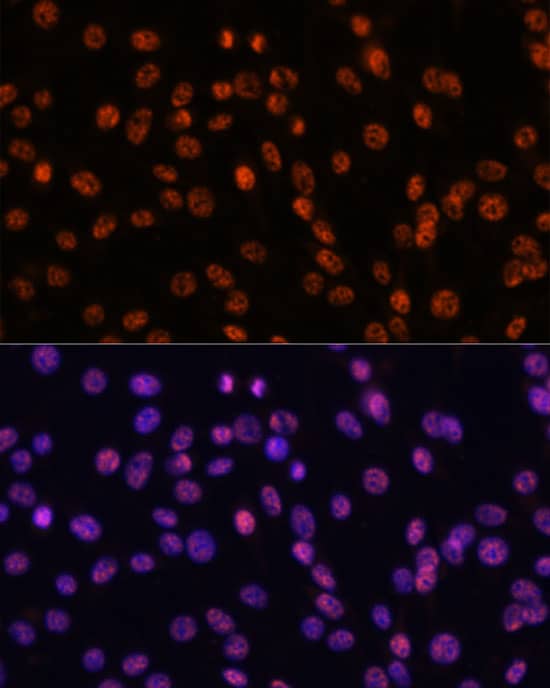 Immunocytochemistry/ Immunofluorescence: SAP155 Antibody [NBP3-35603] - Immunofluorescence analysis of C6 using SAP155 Rabbit pAb at dilution of d100 (40x lens). Blue: DAPI for nuclear staining.