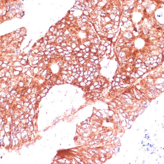 Immunohistochemistry FAM98A Antibody - BSA Free