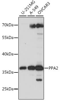 Western Blot: PPA2 Antibody [NBP3-35606] - Western blot analysis of various lysates using PPA2 Rabbit pAb at 1:1000 dilution.Secondary antibody: HRP-conjugated Goat anti-Rabbit IgG (H+L) at 1:10000 dilution.Lysates/proteins: 25ug per lane.Blocking buffer: 3% nonfat dry milk in TBST.Detection: ECL Basic Kit.Exposure time: 10s.