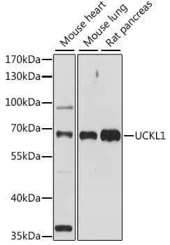 Western Blot: UCKL1 Antibody [NBP3-35608] - Western blot analysis of various lysates using UCKL1 Rabbit pAb at 1:1000 dilution.Secondary antibody: HRP-conjugated Goat anti-Rabbit IgG (H+L) at 1:10000 dilution.Lysates/proteins: 25ug per lane.Blocking buffer: 3% nonfat dry milk in TBST.Detection: ECL Basic Kit.Exposure time: 90s.