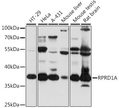 Western Blot: P15RS Antibody [NBP3-35610] - Western blot analysis of various lysates using P15RS Rabbit pAb at 1:1000 dilution.Secondary antibody: HRP-conjugated Goat anti-Rabbit IgG (H+L) at 1:10000 dilution.Lysates/proteins: 25ug per lane.Blocking buffer: 3% nonfat dry milk in TBST.Detection: ECL Basic Kit.Exposure time: 10s.