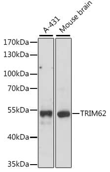 Western Blot: TRIM62 Antibody [NBP3-35611] - Western Blot analysis of various lysates using TRIM62 Rabbit pAb at 1:1000 dilution.Secondary antibody: HRP-conjugated Goat anti-Rabbit IgG (H+L) at 1:10000 dilution.Lysates/proteins: 25ug per lane.Blocking buffer: 3% nonfat dry milk in TBST.Detection: ECL Basic Kit.Exposure time: 90s.