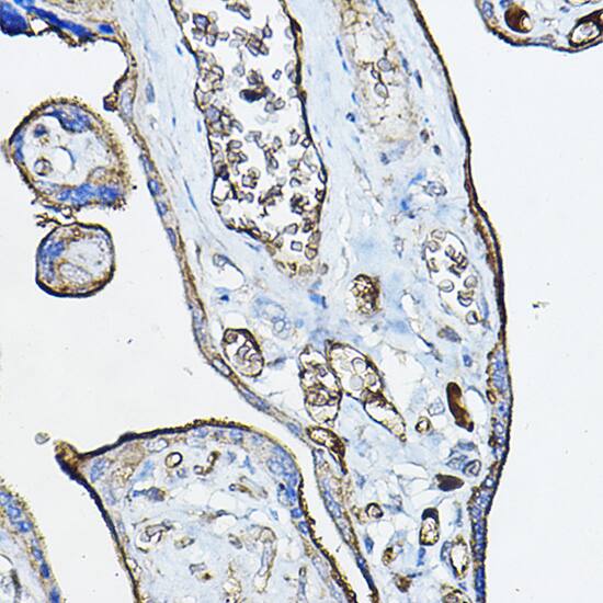 Immunohistochemistry: Nicotinic Acetylcholine R alpha 7/CHRNA7 Antibody [NBP3-35614] - Immunohistochemistry analysis of paraffin-embedded Human placenta using Nicotinic Acetylcholine R alpha 7/CHRNA7 Rabbit pAb at dilution of 1:100 (40x lens). Microwave antigen retrieval performed with 0.01M PBS Buffer (pH 7.2) prior to IHC staining.