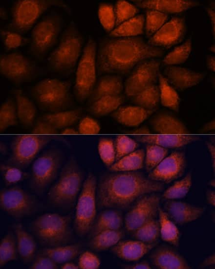 Immunocytochemistry/ Immunofluorescence KIF13A Antibody