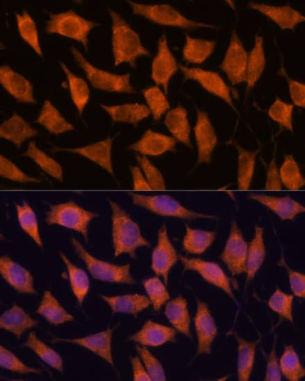 Immunocytochemistry/ Immunofluorescence: KIF13A Antibody [NBP3-35615] - Immunofluorescence analysis of L929 cells using KIF13A Rabbit pAb at dilution of 1:100. Secondary antibody: Cy3-conjugated Goat anti-Rabbit IgG (H+L) at 1:500 dilution. Blue: DAPI for nuclear staining.