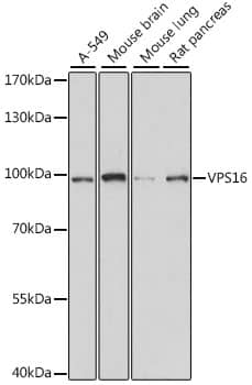 Western Blot: VPS16 Antibody [NBP3-35617] - Western blot analysis of various lysates using VPS16 Rabbit pAb at 1:1000 dilution.Secondary antibody: HRP-conjugated Goat anti-Rabbit IgG (H+L) at 1:10000 dilution.Lysates/proteins: 25ug per lane.Blocking buffer: 3% nonfat dry milk in TBST.Detection: ECL Basic Kit.Exposure time: 1s.