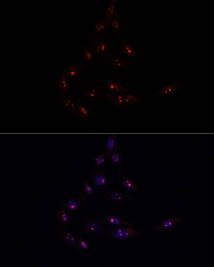 Immunocytochemistry/ Immunofluorescence: METT10D Antibody [NBP3-35618] - Immunofluorescence analysis of NIH/3T3 cells using METT10D Rabbit pAb at dilution of 1:100. Secondary antibody: Cy3-conjugated Goat anti-Rabbit IgG (H+L) at 1:500 dilution. Blue: DAPI for nuclear staining.