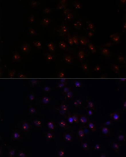 Immunocytochemistry/ Immunofluorescence: METT10D Antibody [NBP3-35618] - Immunofluorescence analysis of C6 cells using METT10D Rabbit pAb at dilution of 1:100. Secondary antibody: Cy3-conjugated Goat anti-Rabbit IgG (H+L) at 1:500 dilution. Blue: DAPI for nuclear staining.