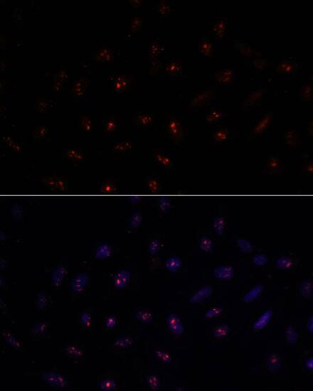 Immunocytochemistry/ Immunofluorescence: METT10D Antibody [NBP3-35618] - Immunofluorescence analysis of U-2 OS cells using METT10D Rabbit pAb at dilution of 1:100. Secondary antibody: Cy3-conjugated Goat anti-Rabbit IgG (H+L) at 1:500 dilution. Blue: DAPI for nuclear staining.