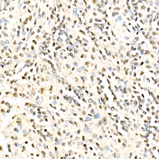 Immunohistochemistry METT10D Antibody - BSA Free
