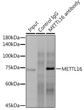 Immunoprecipitation: METT10D Antibody [NBP3-35618] - Immunoprecipitation analysis of 300 ug extracts of LNCaP cells using 3 ug METT10D antibody. Western blot was performed from the immunoprecipitate using METT10D at a dilution of 1:1000.