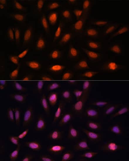 Immunocytochemistry/ Immunofluorescence: PPIL4 Antibody [NBP3-35619] - Immunofluorescence analysis of U-2 OS cells using PPIL4 Rabbit pAb at dilution of 1:100. Secondary antibody: Cy3-conjugated Goat anti-Rabbit IgG (H+L) at 1:500 dilution. Blue: DAPI for nuclear staining.