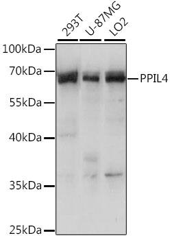 Western Blot: PPIL4 Antibody [NBP3-35619] - Western blot analysis of various lysates using PPIL4 Rabbit pAb at 1:1000 dilution.Secondary antibody: HRP-conjugated Goat anti-Rabbit IgG (H+L) at 1:10000 dilution.Lysates/proteins: 25ug per lane.Blocking buffer: 3% nonfat dry milk in TBST.Detection: ECL Basic Kit.Exposure time: 10s.