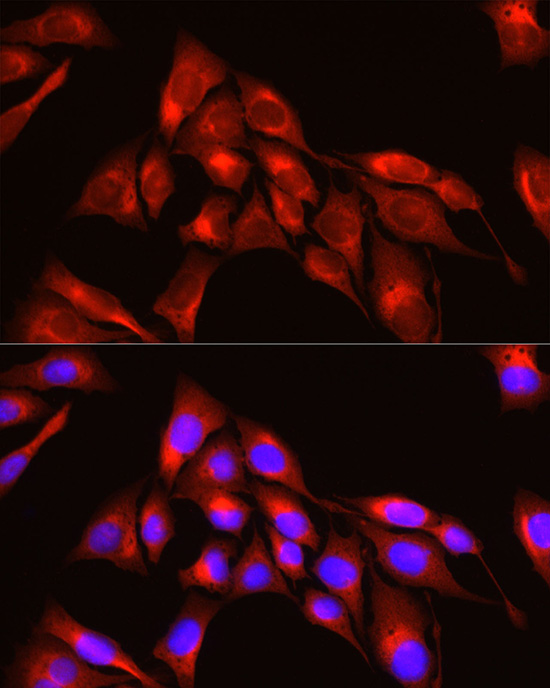 Immunocytochemistry/ Immunofluorescence: TRIM4 Antibody [NBP3-35620] - Immunofluorescence analysis of U2OS cells using TRIM4 Rabbit pAb at dilution of 1:200 (40x lens). Blue: DAPI for nuclear staining.