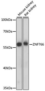 Western Blot: ZNF766 Antibody [NBP3-35621] - Western blot analysis of various lysates using ZNF766 Rabbit pAb at 1000 dilution.Secondary antibody: HRP-conjugated Goat anti-Rabbit IgG (H+L) at 1:10000 dilution.Lysates/proteins: 25ug per lane.Blocking buffer: 3% nonfat dry milk in TBST.Detection: ECL Basic Kit.Exposure time: 1s.