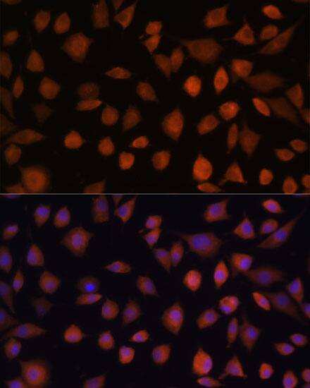Immunocytochemistry/ Immunofluorescence: ARMC6 Antibody [NBP3-35622] - Immunofluorescence analysis of L929 cells using ARMC6 Rabbit pAb at dilution of 1:100. Secondary antibody: Cy3-conjugated Goat anti-Rabbit IgG (H+L) at 1:500 dilution. Blue: DAPI for nuclear staining.